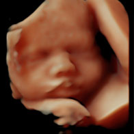 Be Loved 3D/4D/5D/HD Live Combination Bonding Scan
