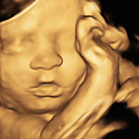 You Are Mine 3D/4D Bonding Scan